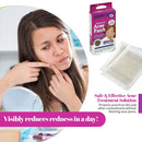 Acne Patch - Spot Dots 72 Count, Hydrocolloid Bandages, Acne Pimple Care Patches Absorbing Round Pads, Blemish Covers MEDca