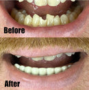 Billy-Bob Instant Smile Teeth Lower Veneer Billy-Bob