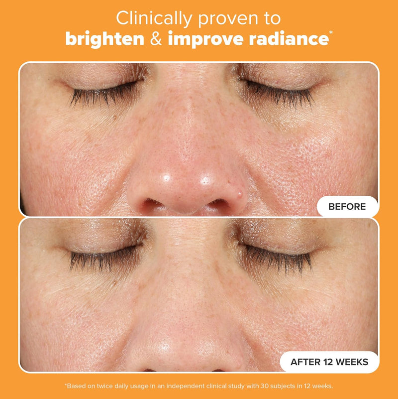 Paula's Choice BOOST C15 Super Booster, 15% Vitamin C Serum for Face, Face Serum with Vitamin E & Ferulic Acid for Discoloration & Glow, Fragrance-Free, 0.67 Fl Oz Infinity Warehouse
