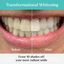 GLO Science So Brilliant Tooth Whitener Set – Fast, Sensitivity Free Teeth Whitening Technology – Includes Warming Mouthpiece with LED Light, 6% Hydrogen Peroxide Gel Pods, Lip Balm, & Travel Case Infinity Warehouse