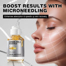 Salmon DNA Serum – Salmon DNA Microneedling Serums for Face and Body, Anti-Aging Hydration Booster, Skin Repair, Brightening & Firming Serum for Use with Microneedling, Derma Roller & Pen Infinity Warehouse