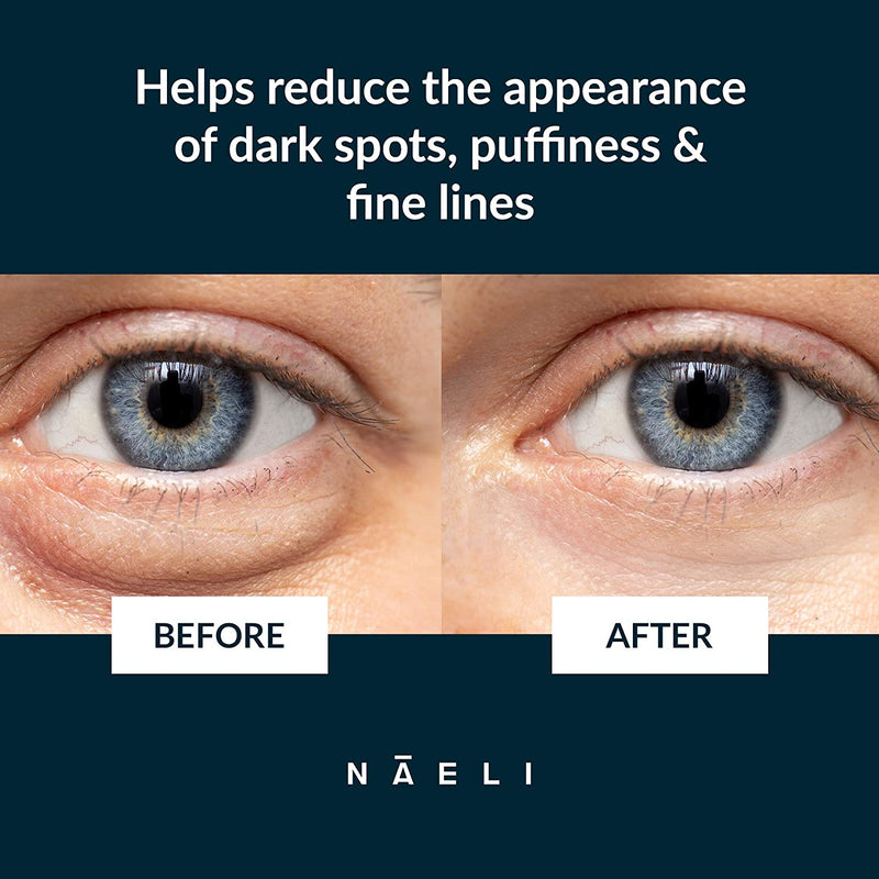 Eye Cream for Dark Circles, Puffiness & Wrinkles with Anti Aging Apple Stem Cell & Peptide Complex - Reduces Fine Lines, Diminishes Bags & Restores Under Eye, 1.4 oz. NAELI Store