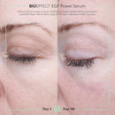 BIOEFFECT EGF Power Serum | Epidermal Growth Factor + KGF + Hyaluronic Acid | Intensive Age-Defying Face Treatment for Deep Wrinkles, Firmness & Skin Renewal, 15 mL / 0.50 oz Infinity Warehouse