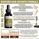 KEAPURE Derma Roller for Hair Growth - 50 ml Natural Hair Regrowth Serum + Wooden Hair Scalp Massager and Micro Needling Roller for Hair | Advanced Scalp Stimulator Hair Regrowth for Men and Woman KEAPURE
