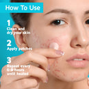 Acne Patches (120 Pack), Tea Tree Oil and Hydrocolloid Pimple Patches for Face, Zit Patch (3 Sizes), Blemish Patches, Acne Dots, Pimple Stickers, 100% All Natural Acne Patch and Pimple Patch BASIC CONCEPTS