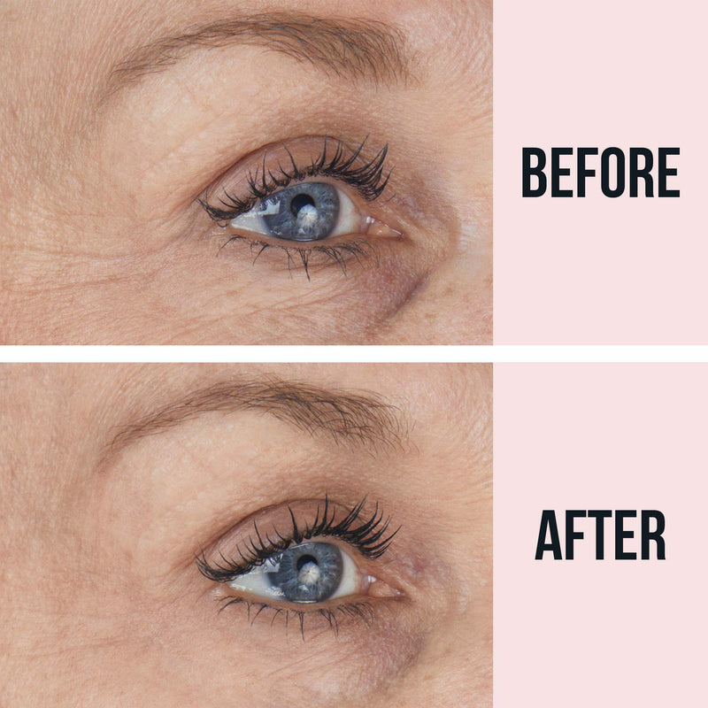 SiO Beauty Eye and Smile Lift Anti-Wrinkle Patches 4 Week Supply - Overnight Under Eye Mask Pads For Dark Circles - Silicone Skin Treatment For Wrinkles SiO