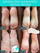 Foot Peel Mask - Dermatologically Tested - 2 Pack (Pairs) Exfoliating Foot Mask - Makes Feet Baby Soft by Peeling away Calluses & Dead Skin Remover by SUNATORIA - Updated Formula (Aloe Vera) SUNATORIA
