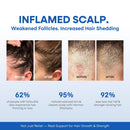 Hermon Folliculitis Shampoo for Itchy Scalp: Psoriasis, Dandruff & Seborrheic Dermatitis & Biotin – Soothes | Exfoliates | Reactivates Follicles Infinity Warehouse