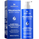 Hermon Folliculitis Shampoo for Itchy Scalp: Psoriasis, Dandruff & Seborrheic Dermatitis & Biotin – Soothes | Exfoliates | Reactivates Follicles Infinity Warehouse