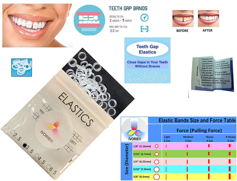 IVORIE Dental Orthodontic Rubber Bands Elastics Braces Teeth Gap 60pcs (3/8" Monkey 6.5oz (X-Heavy)) IVORIE
