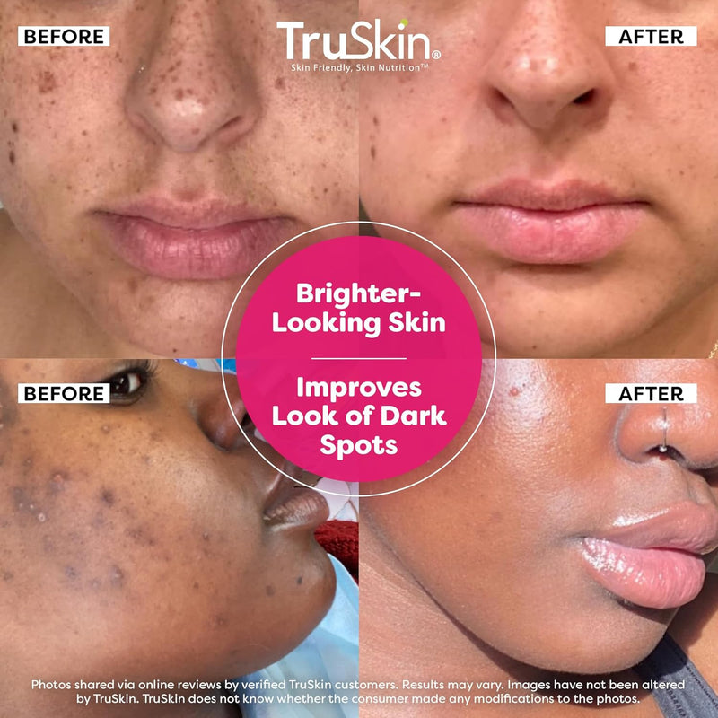 TruSkin Vitamin C Super Serum - Niacinamide, Retinol, Hyaluronic & Salicylic Acid - All-in-One Anti Aging Serum for Face – Improve Appearance of Dark Spots, Firmness for Brighter Looking Skin, 2 Fl Oz Infinity Warehouse