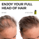 Hair Fibers for Thinning Hair - Volumizing Hair Fillers Are an Undetectable Instant & Safe Root Cover Up - Natural Keratin Protein Adds Texture to Sparse Hair - 18g / 0.63oz (Black) Perfect Hair