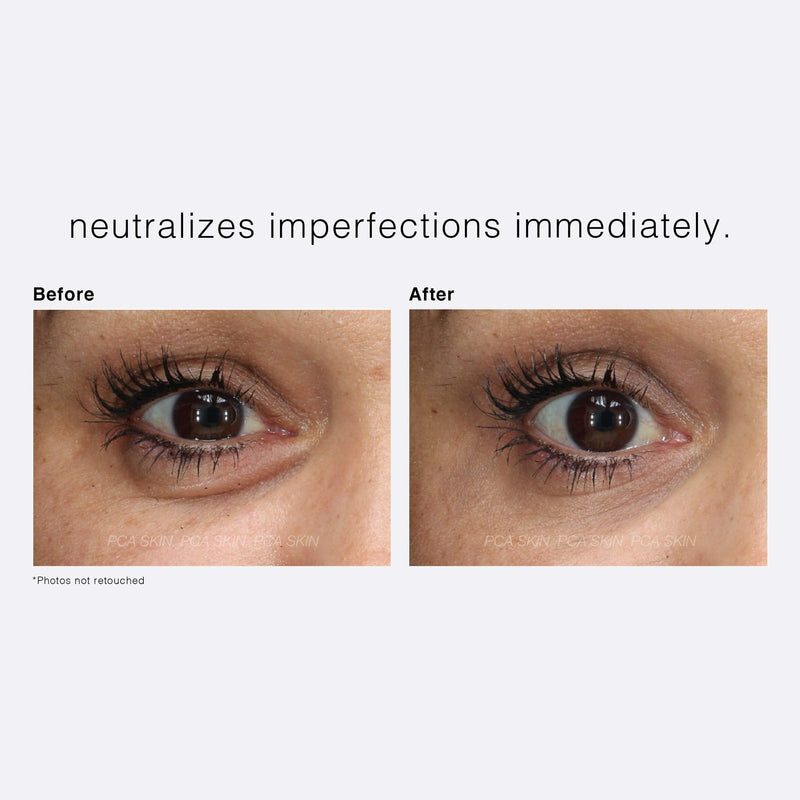 PCA SKIN Sheer Tint Eye - Universally-Tinted Anti-Aging Eye Cream with Triple Complex Broad Spectrum SPF 30 to Reduce Dark Circles, Puffiness, Fine Lines & Wrinkles (0.4 oz) PCA SKIN