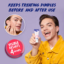 Acne Treatment Cream - Clearasil Rapid Rescue Spot Treatment Cream with Benzoyl Peroxide Acne Medication for Acne Relief in as fast as 4 hours, 1 Ounce Neutrogena