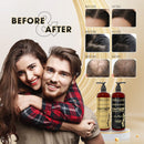 DHT Pro Shampoo and Conditioner Advanced Formula with Procapil and Capixyl, DHT Blockers and Natural Extracts, Hair Loss Solution for Men and Women, Stimulates Follicles, Prevents Thinning Hair Infinity Warehouse