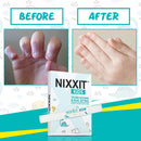 NIXXIT Nail Biting Treatment for Kids - Stop Thumb Sucking for Kids, Toddlers, Children - No Bite Nail Polish Pen - Non Glossy - Bitter Taste - Safe & Effective Solution - Paraben Free NIXXIT