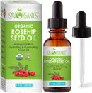 Organic Rosehip Oil by Sky Organics (1oz) Cold-Pressed Rosehip Seed Oil, Anti-aging Face Oil, Antioxidant Face Oil, 100% Pure Anti-Aging Rosehip Seed Oil for Radiant Skin, Hair and Acne Sky Organics
