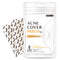 Avarelle Acne Pimple Patch (8 Count) Hydrocolloid Acne Clearing Device Acne Spot Treatment for Blemishes and Zit with Tea Tree Oil, Calendula Oil and Cica Oil for Face, Vegan, Cruelty Free Certified (SQUARE / 8 PATCHES) AVARELLE