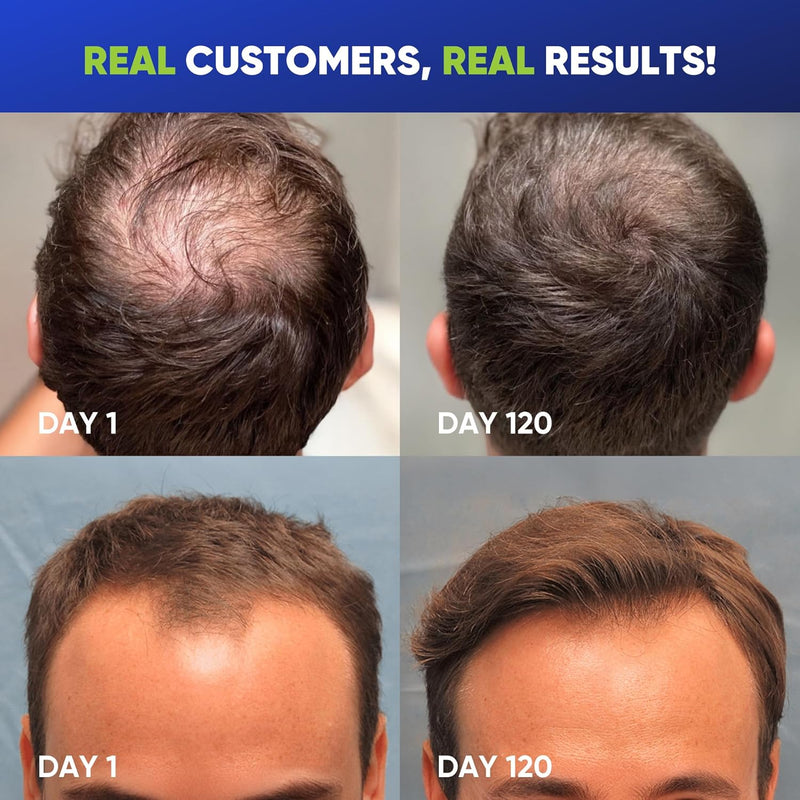 Svvimer Hair Growth Shampoo for Men - Biotin Thickening Shampoo with Rosemary Tea Tree Oil Caffeine for Hair Loss and Thinning - 13.5 Fl Oz (Pack of 1) Infinity Warehouse