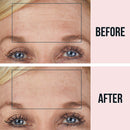 SiO Beauty BrowLift Forehead Anti-Wrinkle Patch - Rapid Overnight Reusable Silicone Patch to Reduce Furrows, Expression Lines, and Creases SiO Store