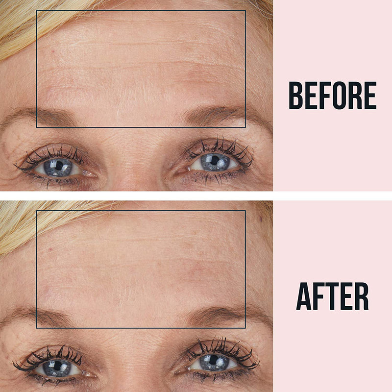 SiO Beauty BrowLift Forehead Anti-Wrinkle Patch - Rapid Overnight Reusable Silicone Patch to Reduce Furrows, Expression Lines, and Creases SiO Store