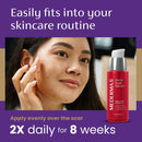 Mederma Acne Scar Serum, Triple-Action Formula with Niacinamide, 1 Fl Oz Infinity Warehouse