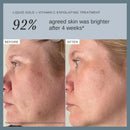 Alpha-H Liquid Gold Exfoliating Treatment 5% Glycolic Acid - Brighten, Even Tone, Smooth Texture, Reduce Appearance of Fine Lines - At-Home Skin Renewal for All Skin Types Infinity Warehouse