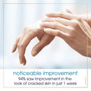 Gold Bond Cracked Skin Relief Fill & Protect Cream 0.75 oz., for Hands, Cuticles, and Feet Gold Bond