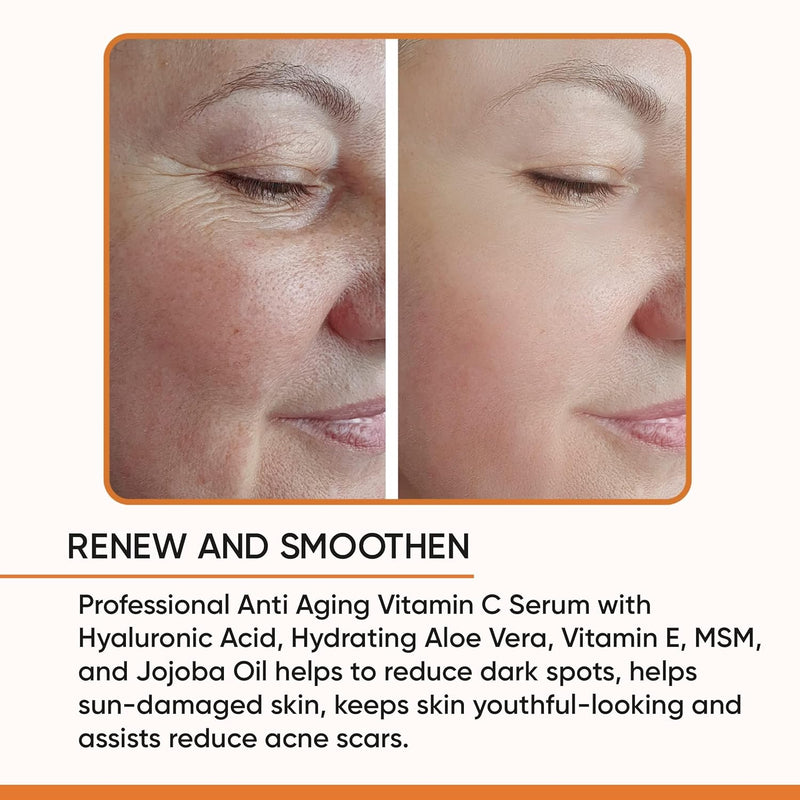 100% PURE VITAMIN C SERUM FOR FACE, Anti Aging Serum with Hyaluronic Acid, Vitamin E, MSM, Aloe Vera, Jojoba Oil, Amino Blend, Hydrating Serum for Dark Spots, Fine Lines and Wrinkles, Skin Repair, Pore Clearing, Acne Scars, Organic Vegan Ingredients - DOU Infinity Warehouse