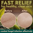 Antifungal Body Wash with Tea Tree Oil | Antibacterial Soap for Back Acne,Treats Ringworm, Eczema & Jock Itch | Antibacterial Body Soap For Men And Women | Includes Silicon Scrubber (16.9 oz) Infinity Warehouse