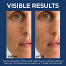 L'Oreal Paris Retinol Serum for Face, Night Serum 0.3% Pure Retinol from Revitalift Derm Intensives, Visibly Reduce Wrinkles, Even Deep Ones, 1 Oz Serum + Moisturizer Cream Samples, Packaging May Vary L'Oreal Paris