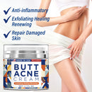 Butt Acne Clearing Cream, Thigh Acne Clearing treatment, Made in USA, Clears Acne, Pimples, and Dark Spots for the Buttocks and Thigh Area. Moisture, Heal and Recover with noticeable result in 4 days BellamiLuxx