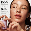 Kate Somerville DeliKate Recovery Serum – Clinically Formulated Hydrating Treatment, Irritation and Redness Relief for Stressed or Sensitive Skin, 1 Fl Oz Infinity Warehouse