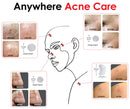 Ax Acne Hydrocolloid Pimple Patch Bandage 88 Variety Pack Skincare Pore Strips Clearing Spot Treatment… Ax Acne