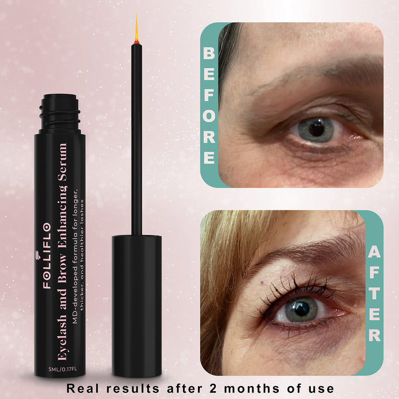 Folliflo by CELL ACCEL Eyelash & Brow Enhancing Serum with Castor Oil & Panax Ginseng - Hair Growth Formula for Longer, Thicker & Healthier Lashes - Developed by a Harvard-Trained Dermatologist Folliflo