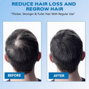 5% Minoxidil Foam for Men, Minoxidil for Women Hair Growth, Infused with Biotin, Hair Growth Treatment, Foam Hair Regrowth Treatment for Hair Thinning Receding Hairline,(2 oz Bottle), 3-Pack Infinity Warehouse
