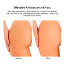 BellamiLuxx Butt Acne Clearing Lotion, Pure Plants Extracts for Reduce Acne and Pimples, Balance Skin Moisture/Sebum, Keep Buttocks Skin Delicate, and Smooth.â¦ BellamiLuxx