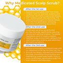 Anti Fungal Pre Shampoo Scalp Scrub for Psoriasis, Eczema & Seborrheic Dermatitis | DHT Blockers, Mineral Complex & Tea Tree Oil | Soothes Scalp and Promotes Hair Growth for Men & Women Infinity Warehouse