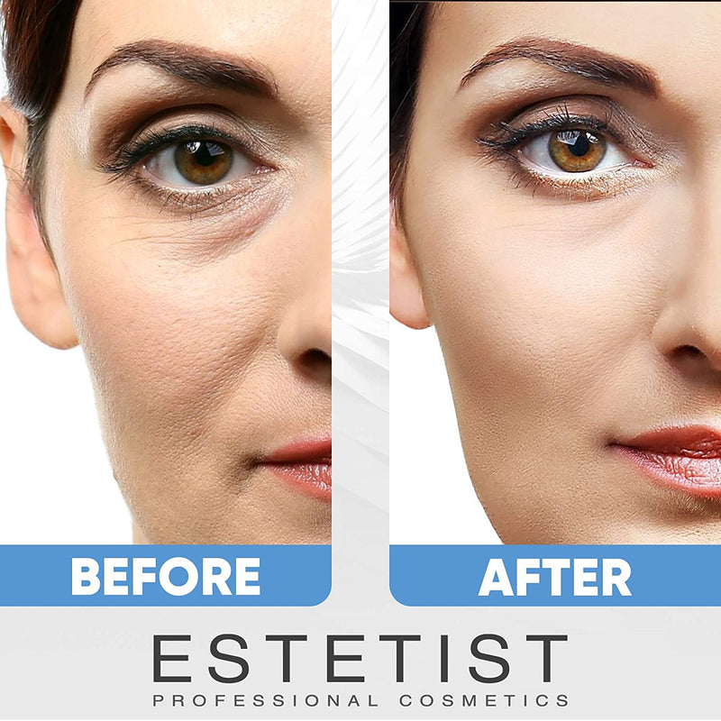 Caffeine Infused Coffee Eye Lift Cream - Reduces Puffiness, Brightens Dark Circles, & Firms Under Eye Bags - Anti Aging, Wrinkle Fighting Skin Treatment ESTETIST Store