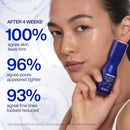 IOPE Expert Retinol RX 2% Reti-Jection Serum - Anti-Aging Night Serum - Visibly Smooths Wrinkles, Firms Skin, and Refines Pores - Potent & Gentle - 1.01 fl. oz. Infinity Warehouse