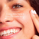 IT Cosmetics Bye Bye Dark Spots 4% Niacinamide Serum - Visibly Reduces Dark Spots & Improves Skin Clarity In 8 Weeks - With 1% Ethyl Vitamin C - For All Skin Types - 1 fl oz It Cosmetics