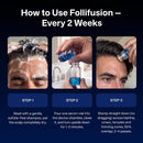 BlueForce Follifusion Hair Microinfusion System – With Copper Peptide Serum Infinity Warehouse