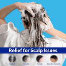 Psoriasis Shampoo, Seborrheic Dermatitis Folliculitis Shampoo, Anti-Fungal and Anti-Dandruff for Men and Women 300ml x 2pcs. Infinity Warehouse