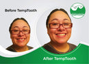 Temptooth