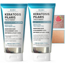 KP Bump Eraser Body Set with 10% AHA | Keratosis Pilaris Treatment | Keratosis Pilaris Lotion | Exfoliating Body Scrub | Ingrown Hair Treatment | Bundle Set for Bump, Strawberry Legs, Redness, Dryness Infinity Warehouse