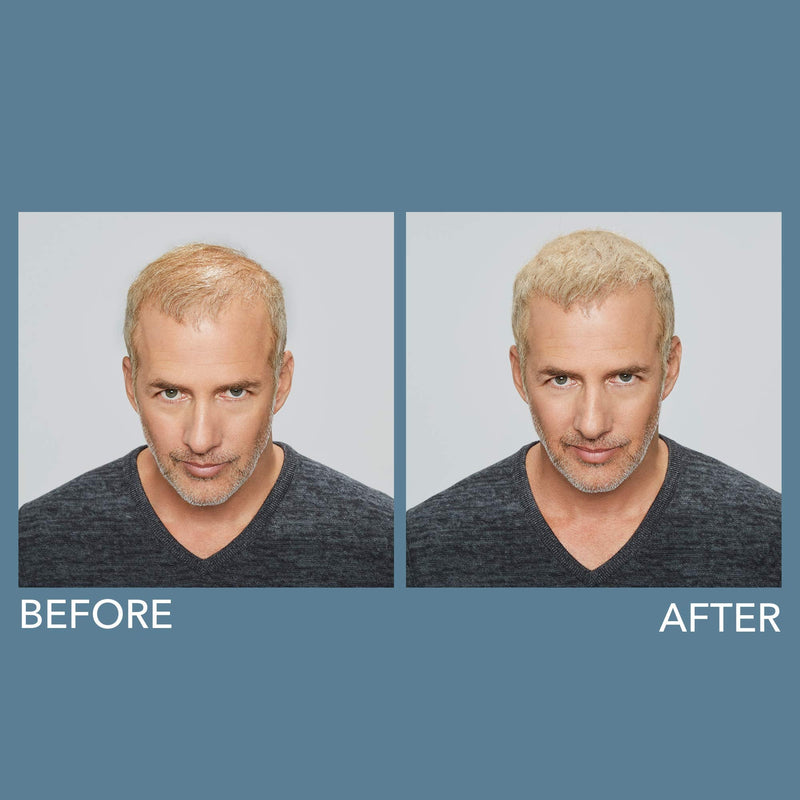 XFusion Keratin Hair Fibers - Medium Brown (15g) XFusion