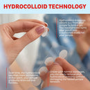 Acne Patches (120 Pack), Hydrocolloid Acne Patch with Tea Tree Oil - Pimple Patches for Face - Zit Patch and Pimple Stickers - Hydrocolloid Acne Dots for Healing Acne with Zit Patches - Acne Treatment KEYCONCEPTS