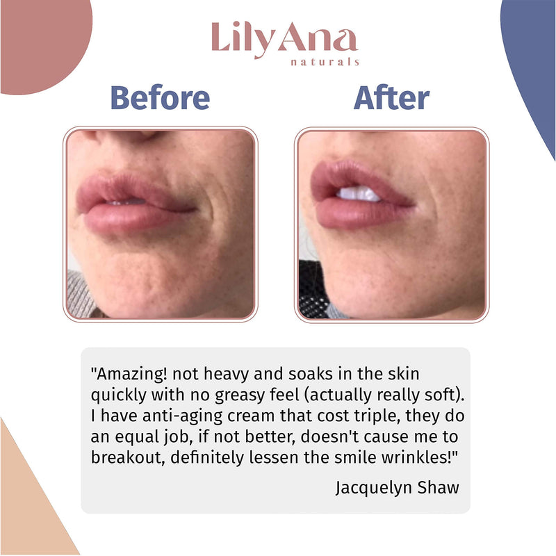 LilyAna Naturals Retinol Cream Moisturizer 1.7 Oz and Vitamin C Serum 1 Oz Bundle - For Face and Eyes, Men and Women - Daily use for Acne, Anti Wrinkle, Anti Aging, Fades Age Spots and Sun Damage LilyAna Naturals