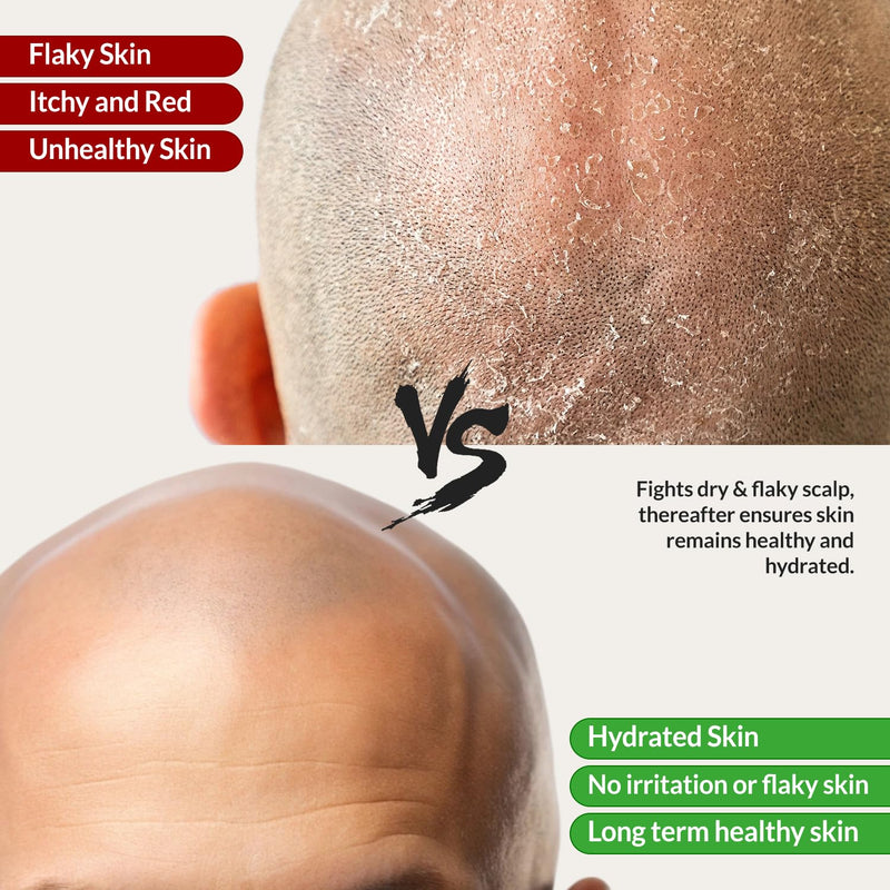 The Bald Brothers Bald Head Care with Apricot Seed Oil | Face & Scalp Moisturizer | Protects, Hydrates, Vegan, No Grease, Matte | Bald Head Moisturizer | No Fragrance | 90 Day Supply | 3oz Infinity Warehouse