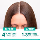 Women's Balance Hair Growth Supplements, Ages 45 and Up, Customer Proven for Visibly Thicker Hair and Scalp Coverage, Soy-Free, Made with 26 Ingredients Including Beta Carotenes - 2 Month Supply Infinity Warehouse